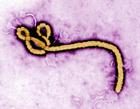 Ebola_virus_(2).jpg
